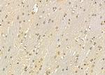 PSMD9 Antibody in Immunohistochemistry (Paraffin) (IHC (P))