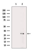 RPS4Y1/RPS4Y2 Antibody in Western Blot (WB)