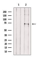 ACOT11 Antibody in Western Blot (WB)