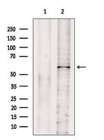 GPT2 Antibody in Western Blot (WB)