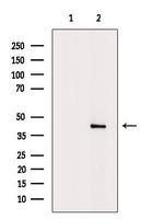 B4GALT2 Antibody in Western Blot (WB)