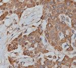 SLC25A13 Antibody in Immunohistochemistry (Paraffin) (IHC (P))