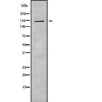 KIF4B Antibody in Western Blot (WB)