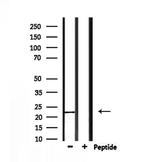 FGF9 Antibody in Western Blot (WB)