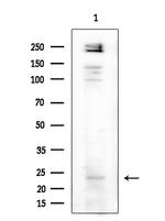 MED28 Antibody in Western Blot (WB)