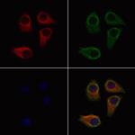 MCT5 Antibody in Immunocytochemistry (ICC/IF)