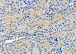 MCT5 Antibody in Immunohistochemistry (Paraffin) (IHC (P))