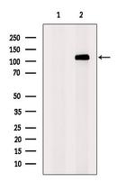 SUGP2 Antibody in Western Blot (WB)