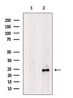 RAB5B Antibody in Western Blot (WB)