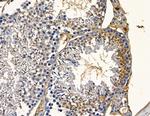 ABCA4 Antibody in Immunohistochemistry (Paraffin) (IHC (P))