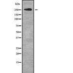 ABCA4 Antibody in Western Blot (WB)