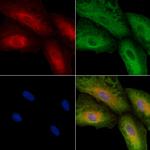 SV2C Antibody in Immunocytochemistry (ICC/IF)