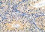 SV2C Antibody in Immunohistochemistry (Paraffin) (IHC (P))