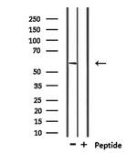 USP17L1 Antibody in Western Blot (WB)