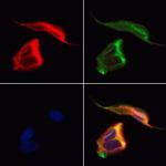 CRMP5 Antibody in Immunocytochemistry (ICC/IF)