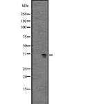 GPR77 Antibody in Western Blot (WB)