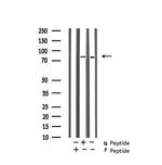 Phospho-Glucocorticoid Receptor (Ser203) Antibody in Western Blot (WB)