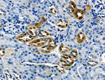 Pan Ras Antibody in Immunohistochemistry (Paraffin) (IHC (P))