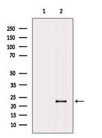 Pan Ras Antibody in Western Blot (WB)