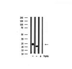 Pan Ras Antibody in Western Blot (WB)