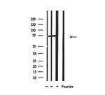 TAP Antibody in Western Blot (WB)