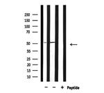 PFKFB1/PFKFB4 Antibody in Western Blot (WB)