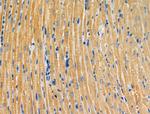 ALPK2 Antibody in Immunohistochemistry (Paraffin) (IHC (P))