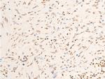 Phospho-JAK1 (Tyr1034) Antibody in Immunohistochemistry (Paraffin) (IHC (P))