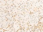 Phospho-JAK1 (Tyr1034) Antibody in Immunohistochemistry (Paraffin) (IHC (P))