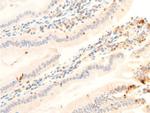 Phospho-JAK1 (Tyr1034) Antibody in Immunohistochemistry (Paraffin) (IHC (P))