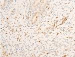 Phospho-JAK1 (Tyr1034) Antibody in Immunohistochemistry (Paraffin) (IHC (P))