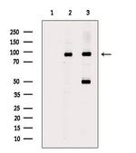 Acetyl-FOXO1 (Lys294) Antibody in Western Blot (WB)