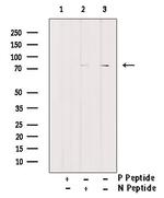 Phospho-HSL (Ser853) Antibody in Western Blot (WB)