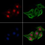 Phospho-CDK6 (Tyr24) Antibody in Immunocytochemistry (ICC/IF)