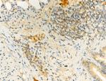 Phospho-IKK alpha/beta (Ser180, Ser181) Antibody in Immunohistochemistry (Paraffin) (IHC (P))