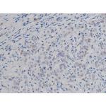 Phospho-IKK alpha/beta (Ser180, Ser181) Antibody in Immunohistochemistry (Paraffin) (IHC (P))