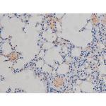 Phospho-IKK alpha/beta (Ser180, Ser181) Antibody in Immunohistochemistry (Paraffin) (IHC (P))