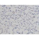 Phospho-IKK alpha/beta (Ser180, Ser181) Antibody in Immunohistochemistry (Paraffin) (IHC (P))