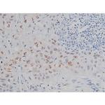 Phospho-IKK alpha/beta (Ser180, Ser181) Antibody in Immunohistochemistry (Paraffin) (IHC (P))