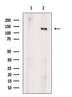 Phospho-JAK2 (Tyr221) Antibody in Western Blot (WB)