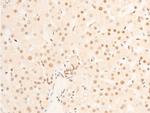 Phospho-TK1 (Ser13) Antibody in Immunohistochemistry (Paraffin) (IHC (P))