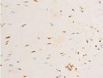 Phospho-TrkA (Tyr680, Tyr681) Antibody in Immunohistochemistry (Paraffin) (IHC (P))