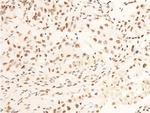 Phospho-TrkA (Tyr680, Tyr681) Antibody in Immunohistochemistry (Paraffin) (IHC (P))