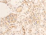 Phospho-TrkA (Tyr680, Tyr681) Antibody in Immunohistochemistry (Paraffin) (IHC (P))