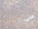 Phospho-TrkA (Tyr680, Tyr681) Antibody in Immunohistochemistry (Paraffin) (IHC (P))