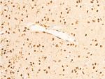 Phospho-TrkA (Tyr680, Tyr681) Antibody in Immunohistochemistry (Paraffin) (IHC (P))