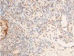 Phospho-TrkA (Tyr680, Tyr681) Antibody in Immunohistochemistry (Paraffin) (IHC (P))