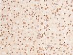 Phospho-c-Jun (Thr93) Antibody in Immunohistochemistry (Paraffin) (IHC (P))