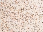 Phospho-c-Jun (Thr93) Antibody in Immunohistochemistry (Paraffin) (IHC (P))