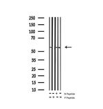 Phospho-Tyrosine Hydroxylase (Ser40) Antibody in Western Blot (WB)